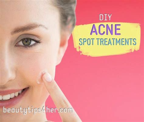 Diy Acne Spot Treatments How To Zap Zits Faster Beauty And Makeup