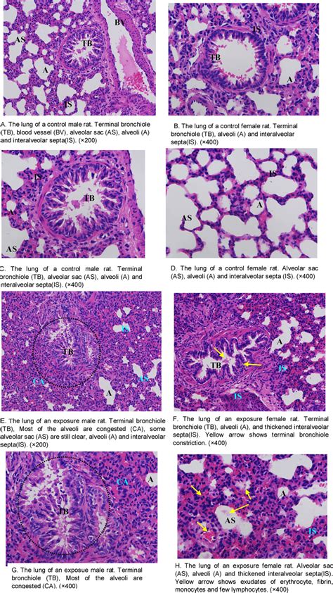 Histopathology Of The Lung Tissue Of Control And Exposure Groups
