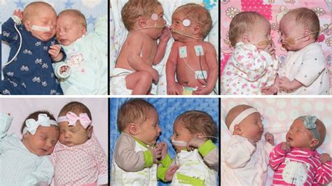 Photos 6 Sets Of Twins Born All In The Same Week At Same Hospital Abc7 Los Angeles