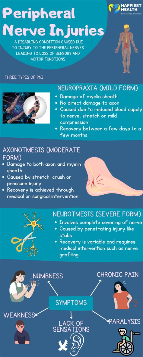 Types Of Peripheral Nerve Injuries Happiest Health