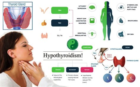 Hypothyroidism An Alternative Holistic Natural Treatment