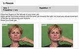 Pictures of Tmj Exercises