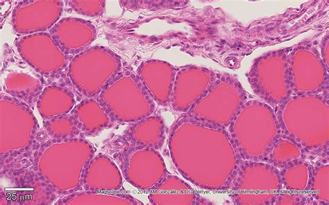 High Magnification Image Of The Thyroid Showing The Simple Cuboidal