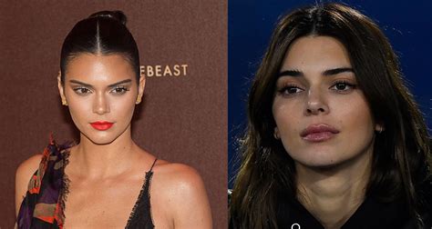 Before And After Kendall Jenner S Face Transformation Who Magazine