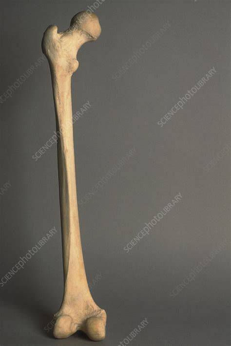 Human Femur - Stock Image - C003/4464 - Science Photo Library