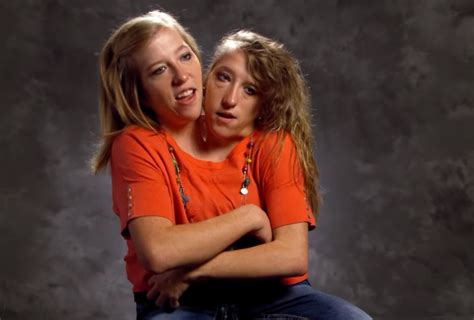 Conjoined Twins Abby And Brittany Now