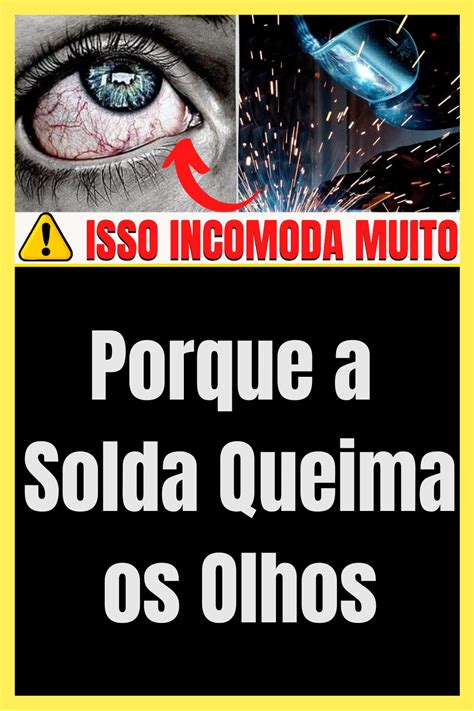 Olho Queimado De Solda O Que Fazer