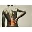 Causes Of Back Pain In Women  Lower