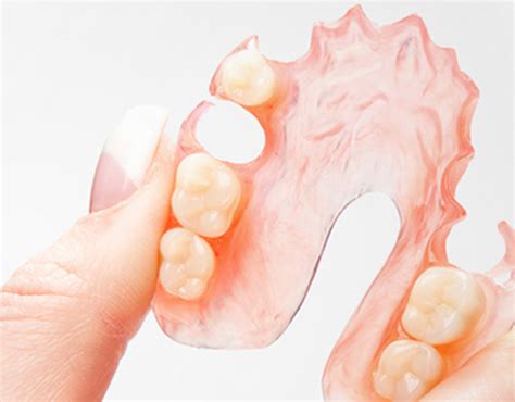 Get Comfortable With Flexible Partial Dentures Try It Now