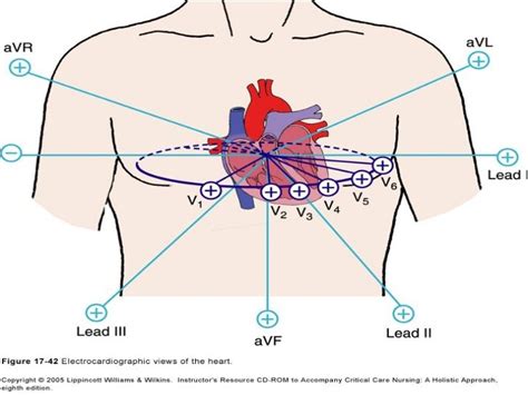 Coronary Arteries And 12 Leads Cardiac Catheterization Cardiology