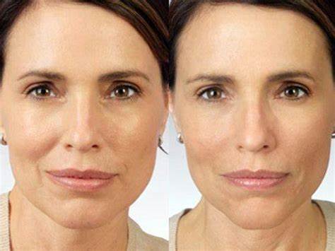 Диета малышевой отзывы и цена