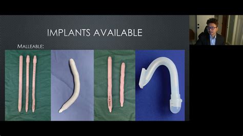 Penile Implants After Phalloplasty Youtube