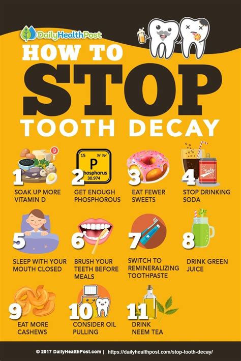 How To Stop Tooth Decay With These 11 Tooth Healthy Habits