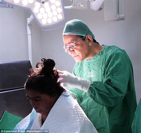 Women Scarred By Acid Attacks Have Reconstructive Surgery Daily Mail Online