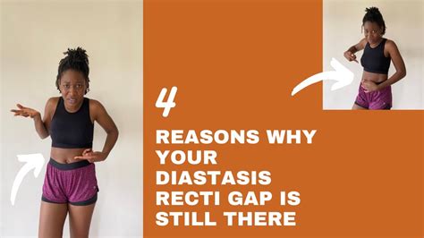 Why Your Diastasis Recti Gap Is Not Reducing Diastasis Recti Tips