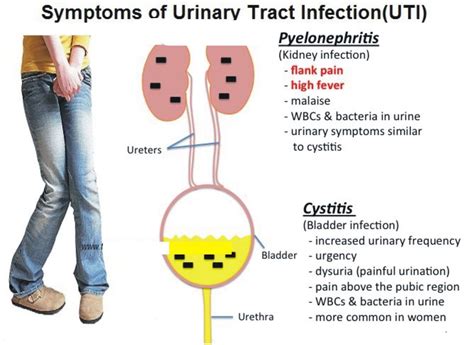 Are Utis A Sign Of Kidney Disease