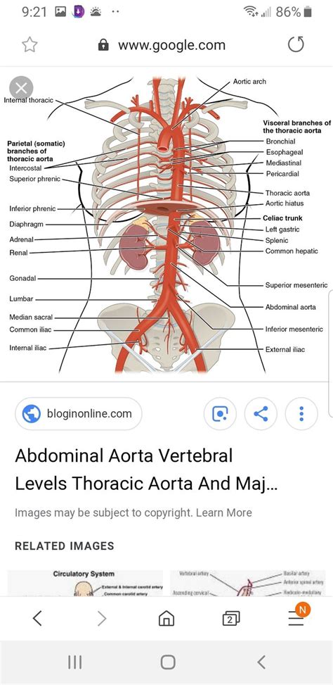 What Is Moderate Atherosclerotic Disease Of The Abdominal Aorta Steve Gallik