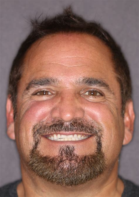 Serious Smile Transformation | South Magazine