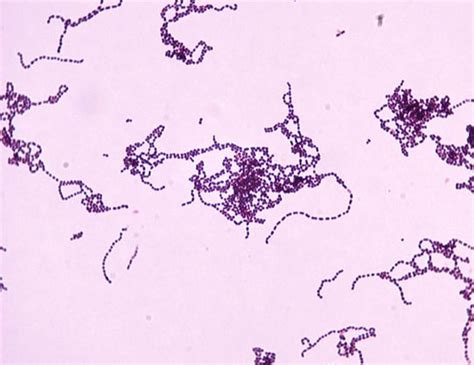Group A Streptococcus Bacteria
