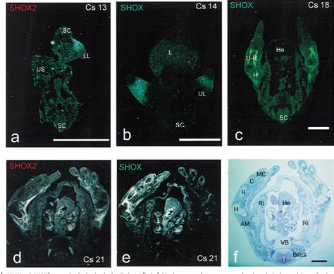 Figure 3 From The Short Stature Homeobox Gene Shox Is Involved In