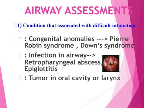Ppt Airway Management And Endotracheal Intubation Powerpoint