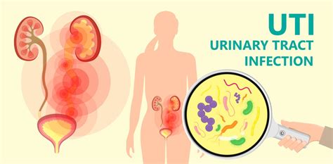 urinary tract infection types causes symptoms treatment