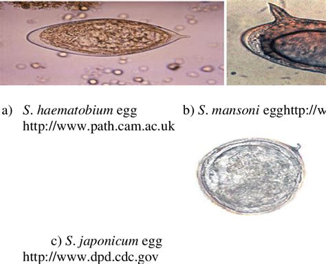 Impact Of Concurrent Schistosoma Mansoni And S Haematobium Infections On Schistosomiasis