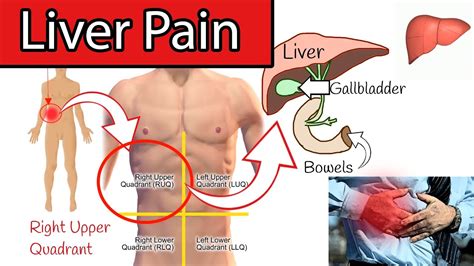 Liver Pain Right Upper Abdominal Pain Right Upper Quadrant Pain YouTube