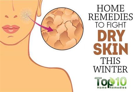 Home Remedies To Fight Dry Skin This Winter Top 10 Home Remedies