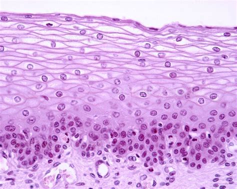 Photograph Stratified Squamous Epithelium Lm Science Source Images