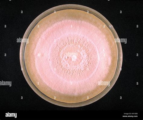 This Photograph Depicts Sabourauds Dextrose Agar Plate Of The Fungi