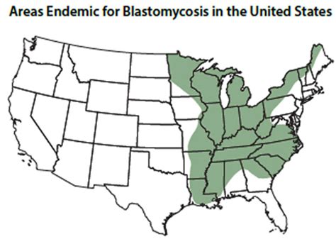 Blastomycosis In Humans Causes Symptoms Diagnosis And Treatment