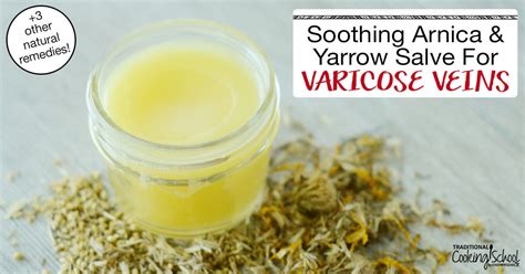 Varicose Veins Treatment Soothing Arnica And Yarrow Salve