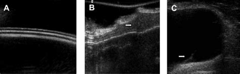 Ultrasound Imaging Notes A Three Separate Shell Layers Can Be