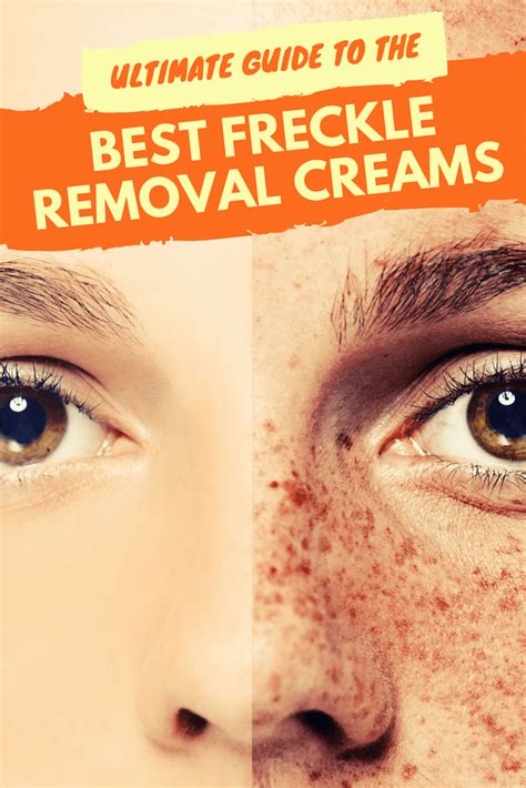 Ultimate Guide To The Best Freckle Removal Creams And Dark Spot Correctors