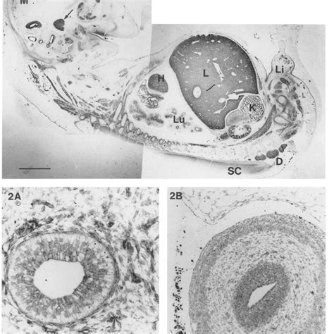A B Fetuin Mrna In A Choroid Plexus Epithelial Cells And B