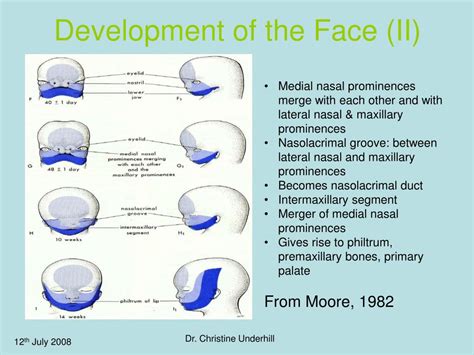 Ppt Orthodontic Management Of Cleft Lip And Palate Patient Powerpoint
