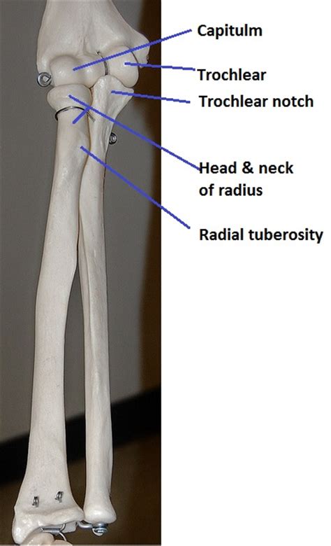 Radius, in anatomy, the outer of the two bones of the forearm when viewed with the palm facing. Gross anatomy of commonly fractured bones