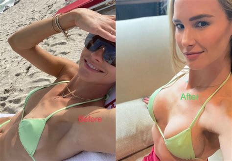 Rhoc See Meghan Kings Before And After Breast Implants Pic
