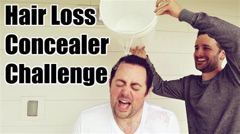 Whats The Best Hair Loss Concealer Youtube