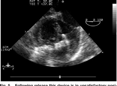 Figure 1 From Pediatric And Congenital Heart Disease Original Studies