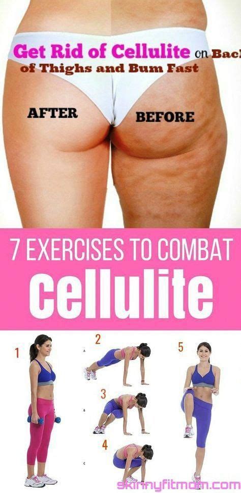 pin on cellulite removal products