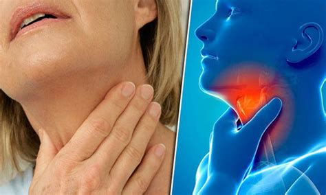 Are You Down With Sore Throat Check Out These Foods That Help You