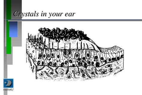 Crystals In Your Ear