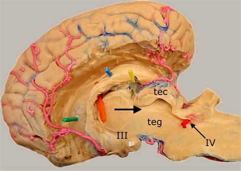 Dissected Equine Brain Median View