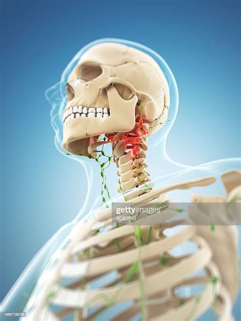 Inflamed Lymph Nodes Artwork High Res Vector Graphic Getty Images