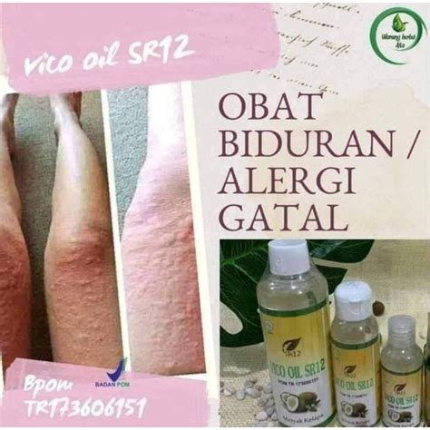 Jual Obat Gatal Biduran Vico Sr12 Paling Ampuhobat Gatal Kulitobat