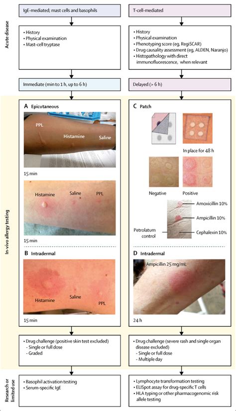 Antibiotic Allergy The Lancet