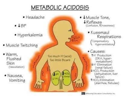 Metabolic Acidosis Cause Symptoms Treatment Mobile Physio