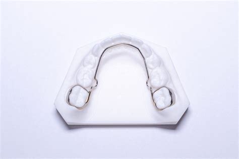 Lingual Arch With Loops Perfect Finish Ortho Lab Inc